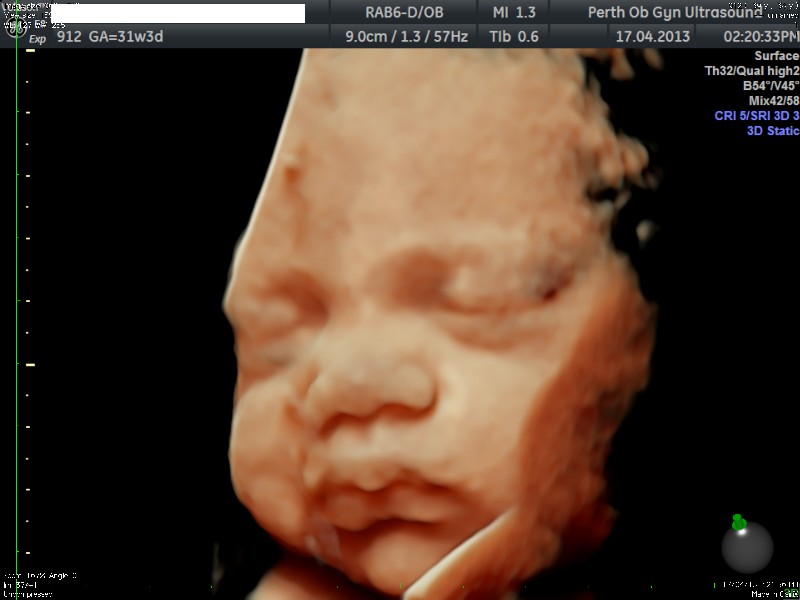 4d ultrasound pictures 24 weeks